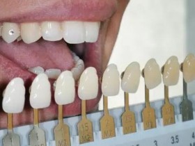 7种获得白牙的方法