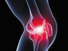 预防退化性膝关节炎　中医建议这样做