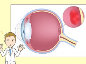 视物扭曲小心黄斑部病变中医养眼治疗有妙招