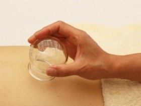 老人拔罐控制在15分钟最养生