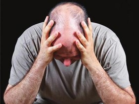 别让头发毛囊提早老去 3点关键防掉发