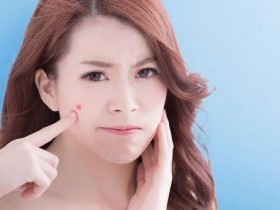 痘痘长在脸颊,吃什麽抗痘?5色食物吃法大不同