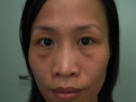 女人有眼袋不要慌,每天定时吃点不贵的它,眼袋淡了皮肤也好了