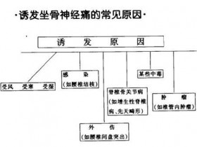 预防坐骨神经痛 谨记五大原则