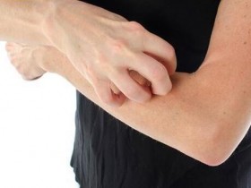 皮痒真难受!中医4招摆脱冬季痒