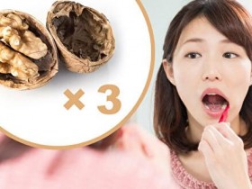 日嚼3核桃牙齿变坚固 中医5招预防牙周病
