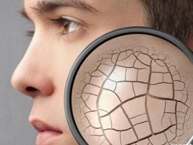 肌肤极度干燥时该怎么办?