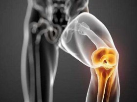 照顾好关节 远离退化性关节炎