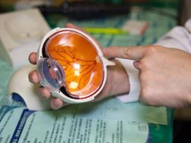 小心会失明!眼中风有2种,视神经中风最棘手!