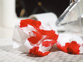 流鼻血的几种原因!不寻常流鼻血要当心