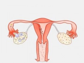 女的什么时候才可以上环,带环注意事项有哪些?女的上环好不好呢?