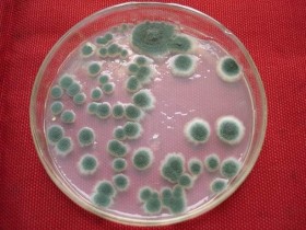 霉菌是什么病?如何治疗?感染和老公有关系吗?