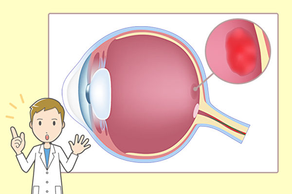 视物扭曲小心黄斑部病变中医养眼治疗有妙招