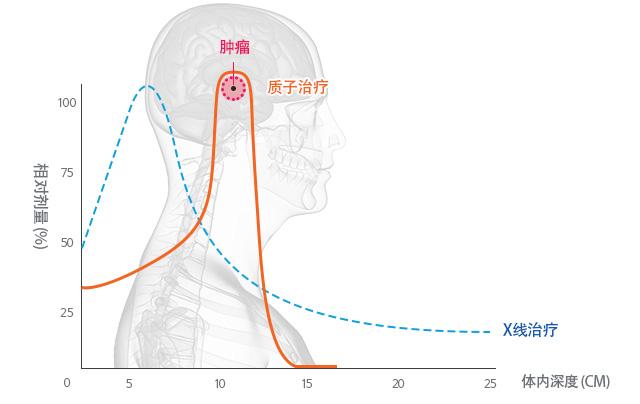 质子治疗副作用低儿童抗癌救星