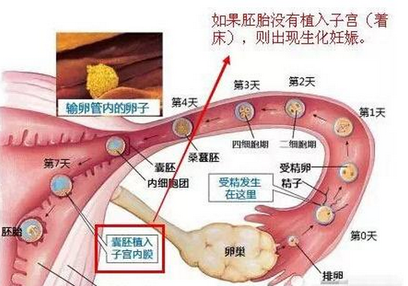 怀孕生化是什么意思，多久后可以怀孕？胚胎流产前兆！